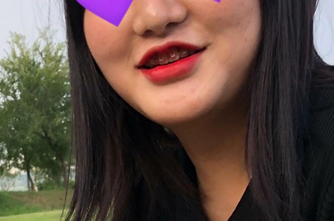 後