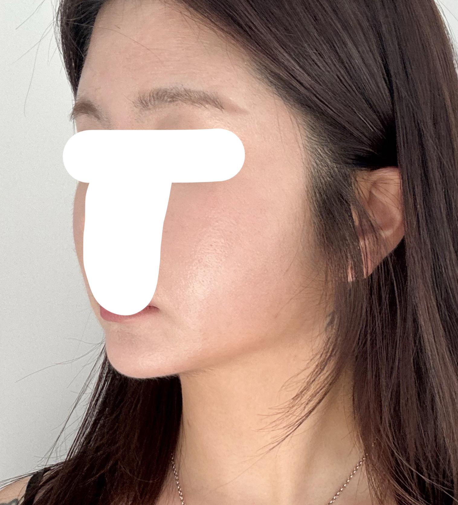 後