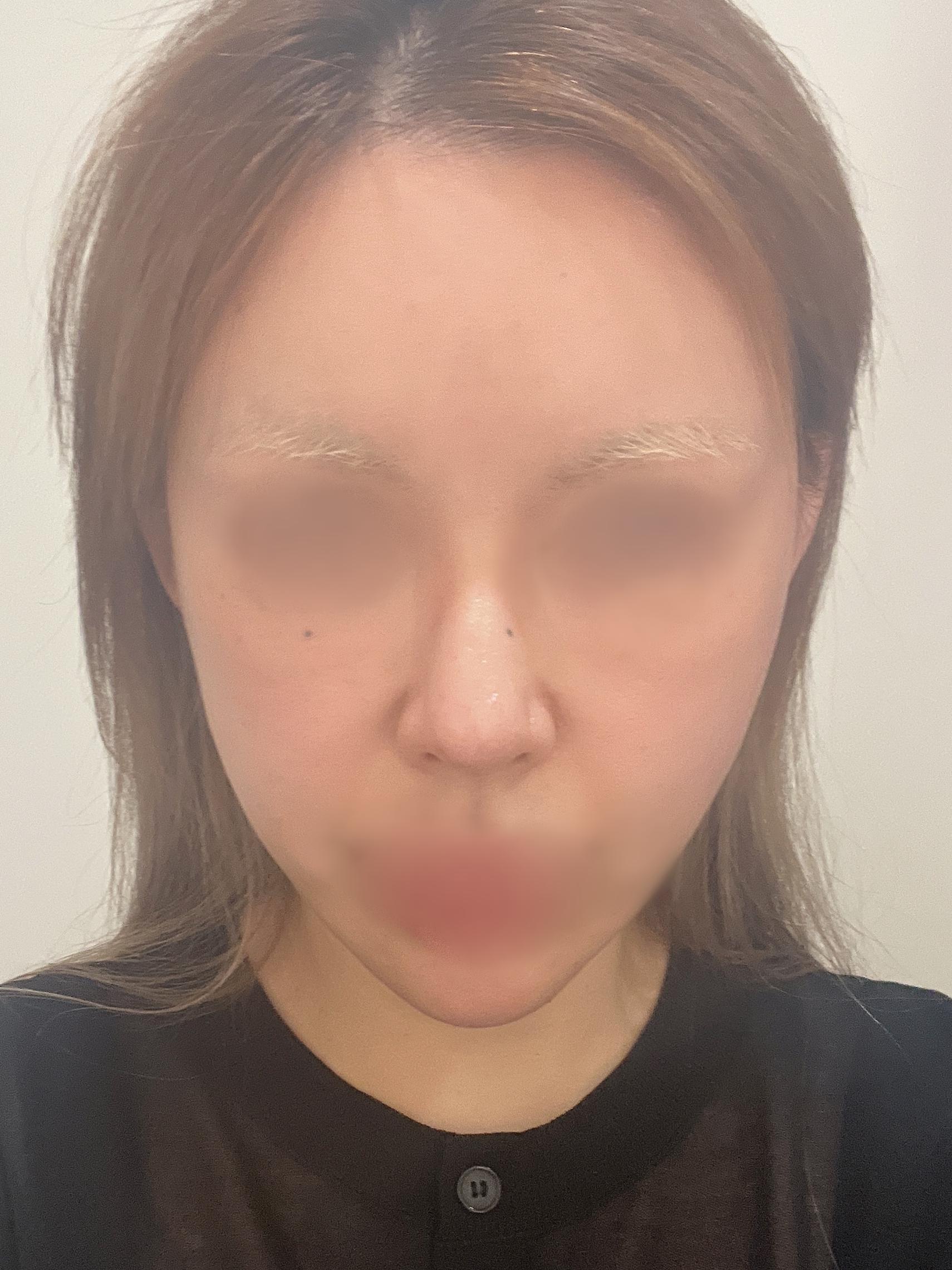 後