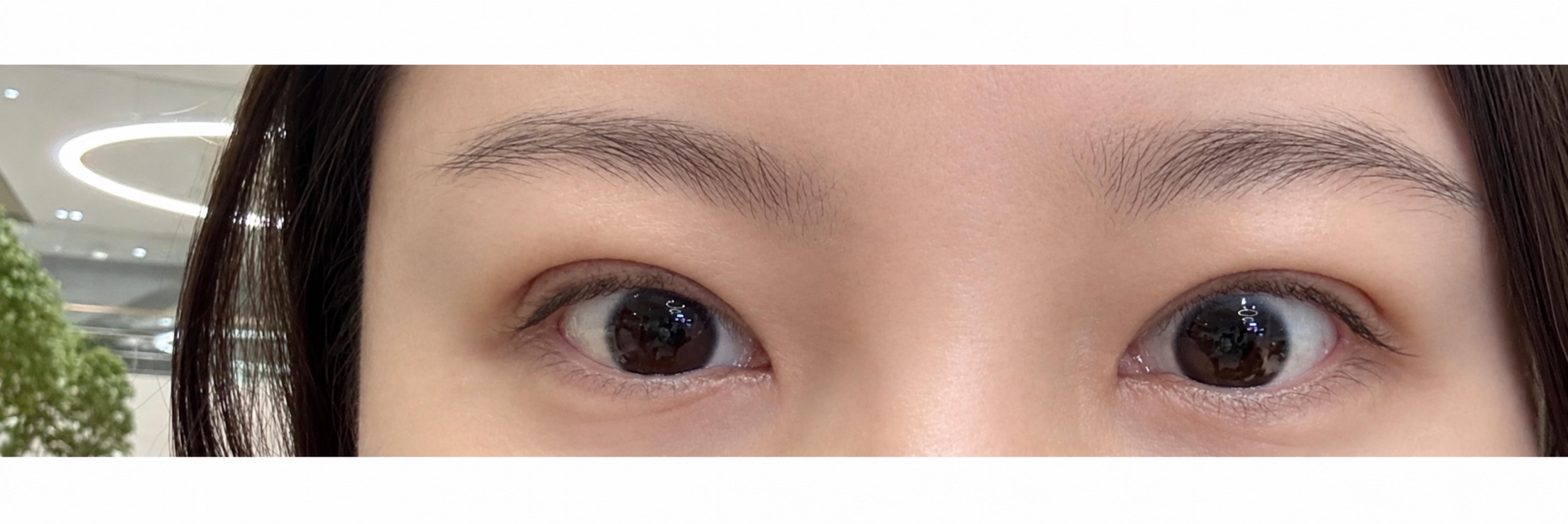 后