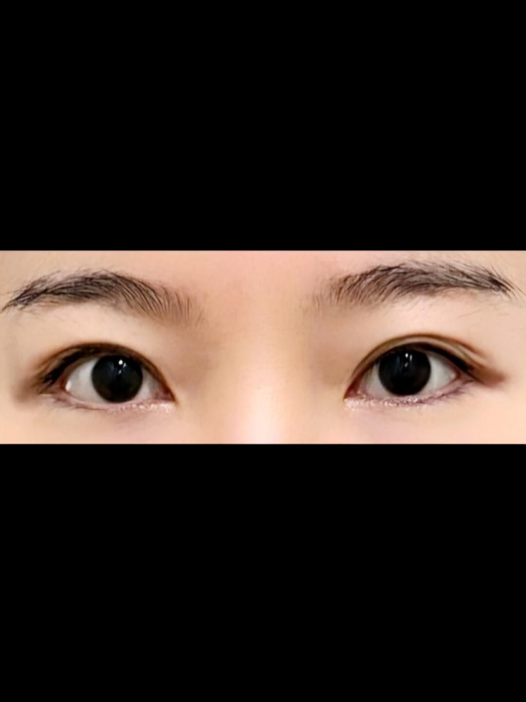 後