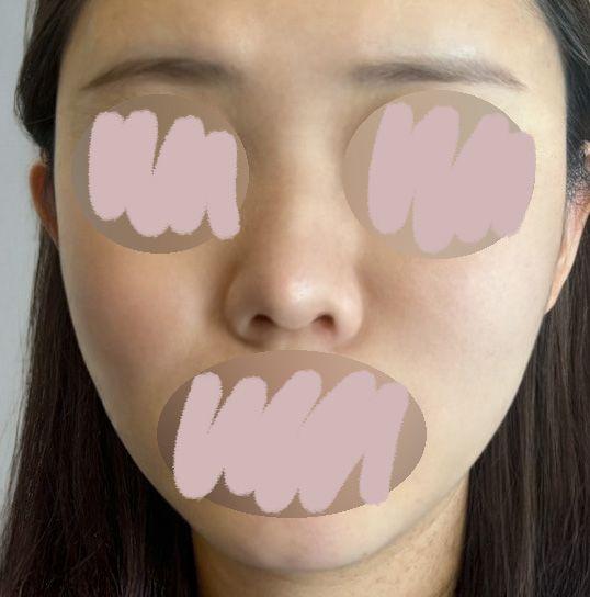 後