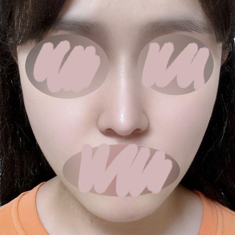 後