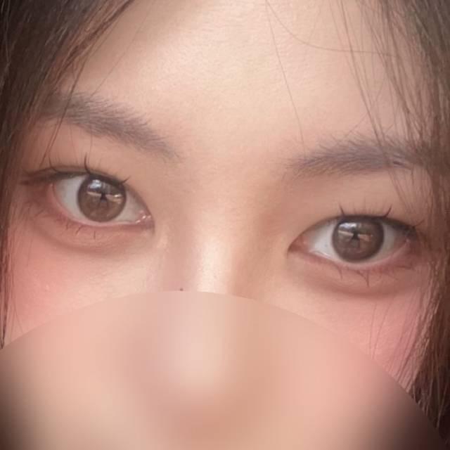 後