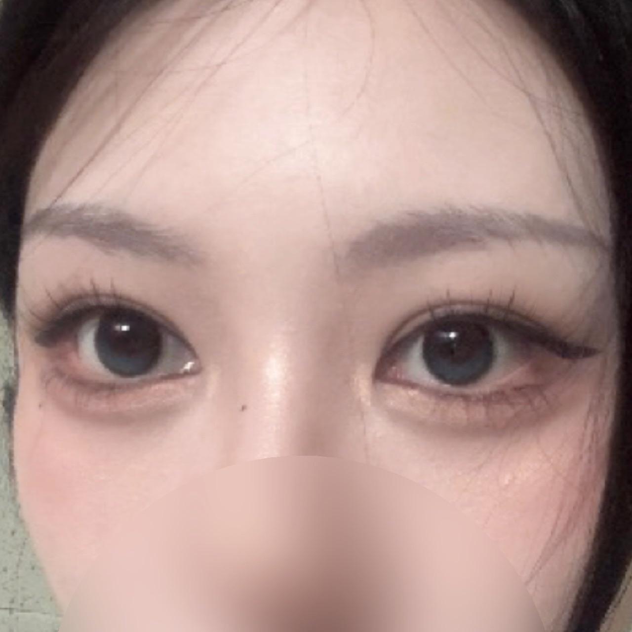 後