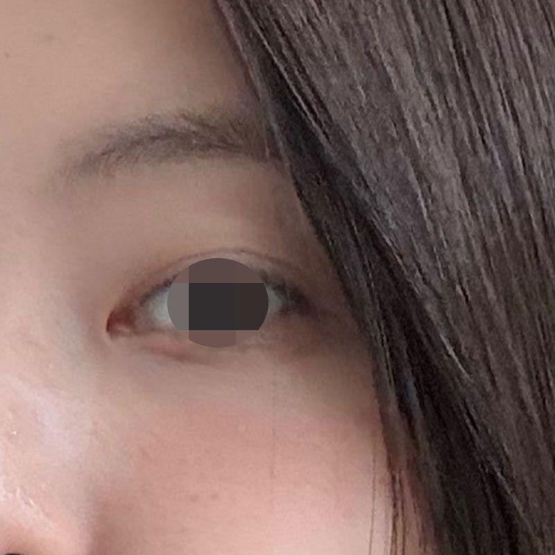 后