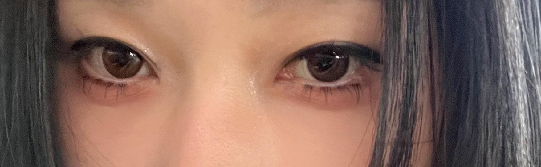 後