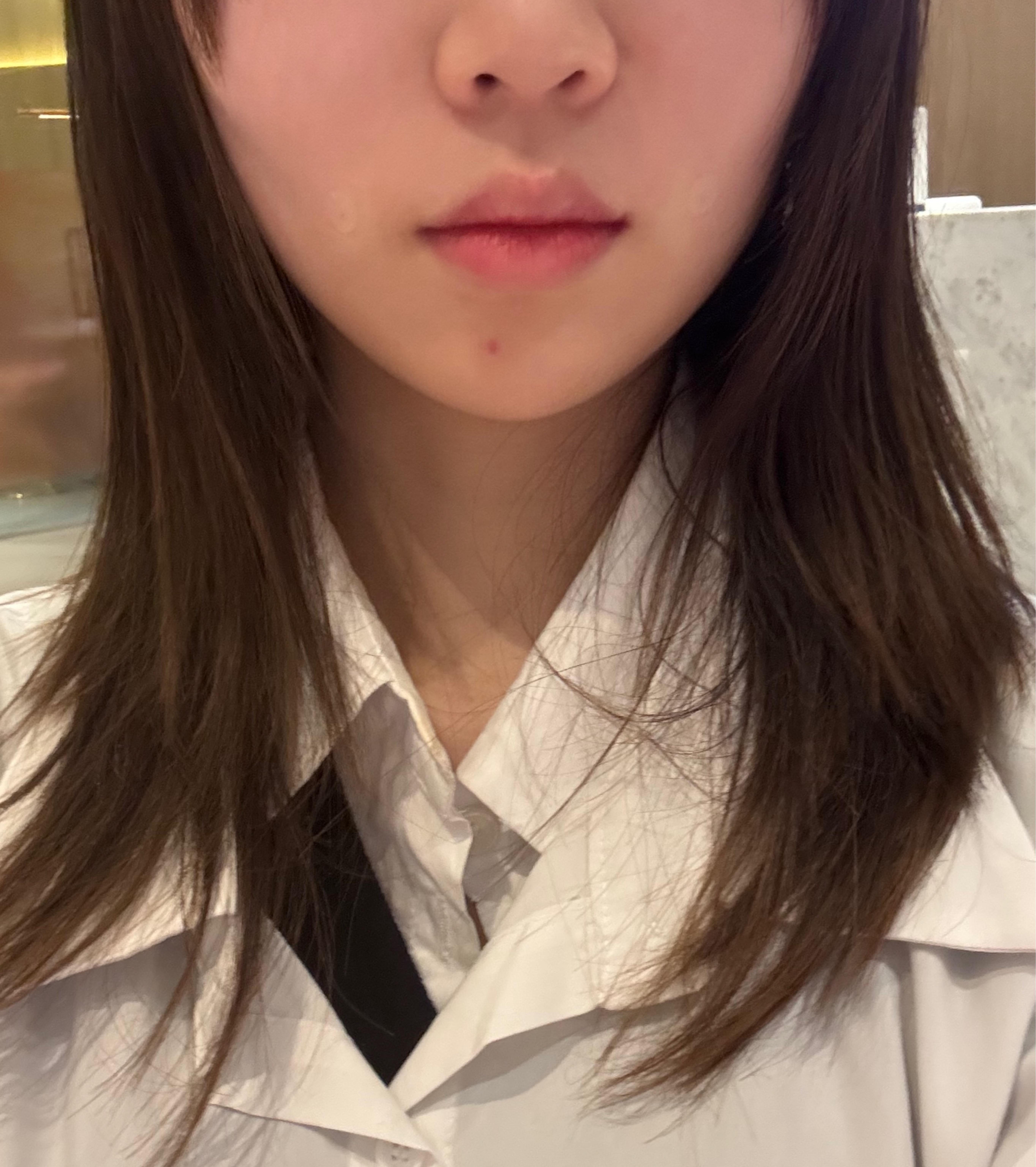 後