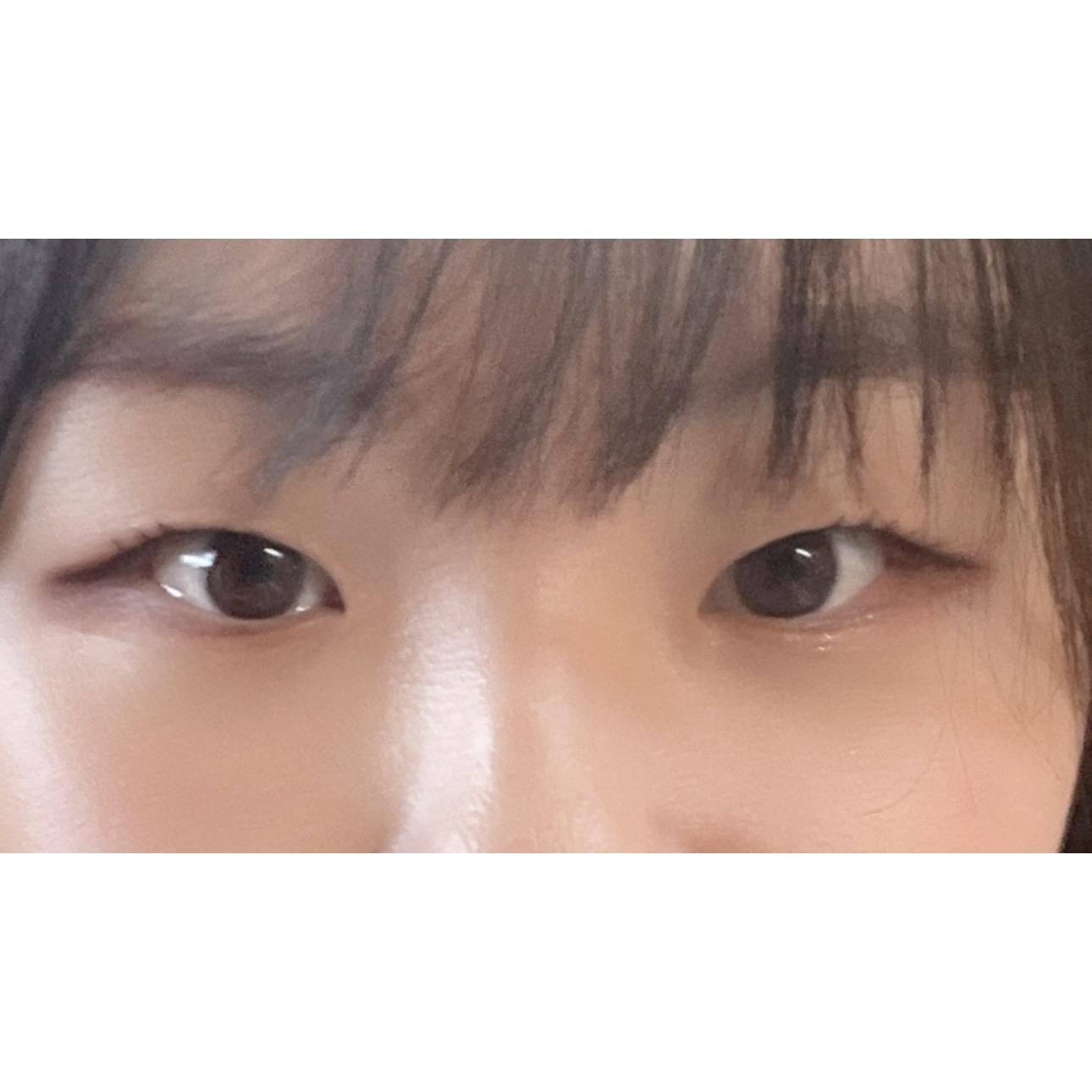 後