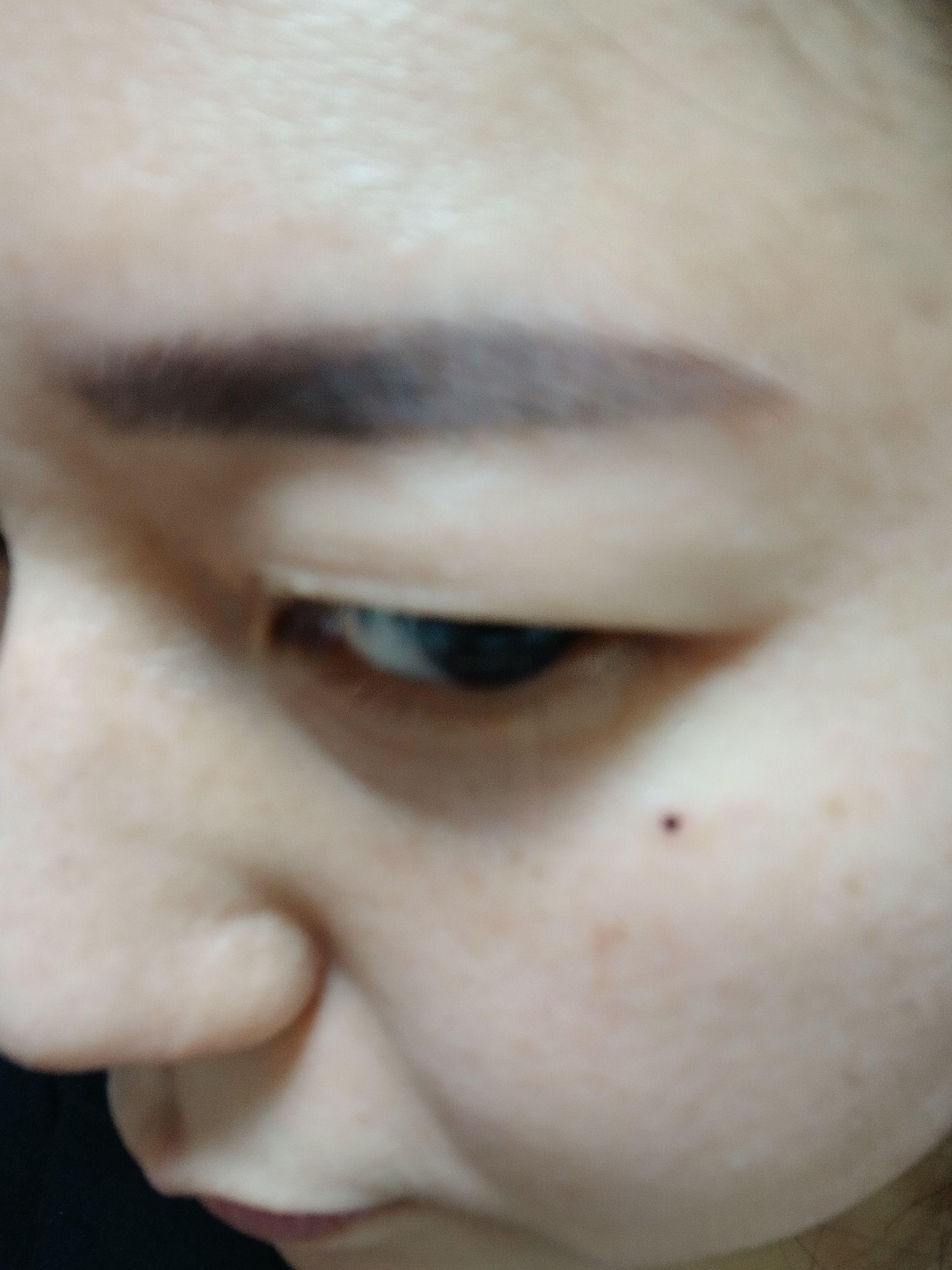 後