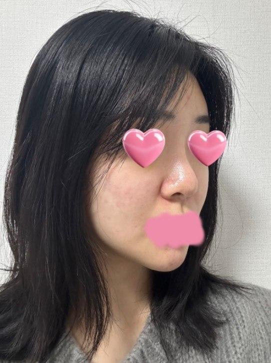 後