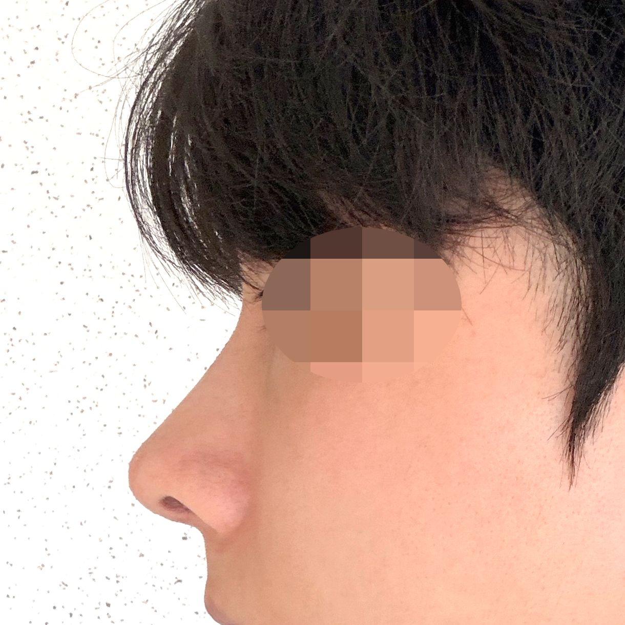 後