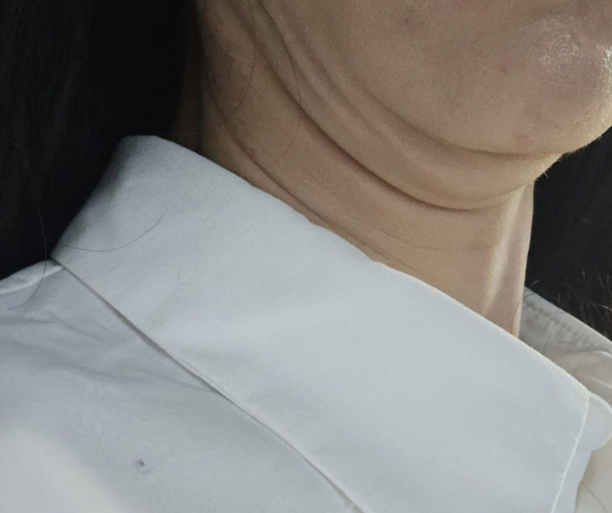 後
