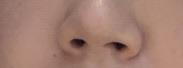後