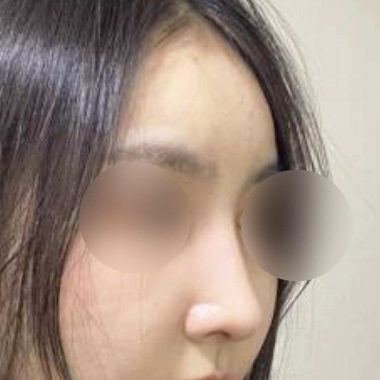 後