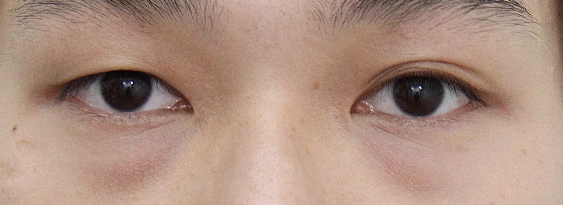 後