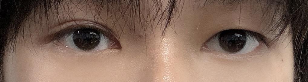 後