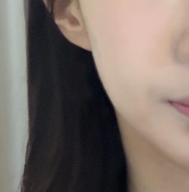 前