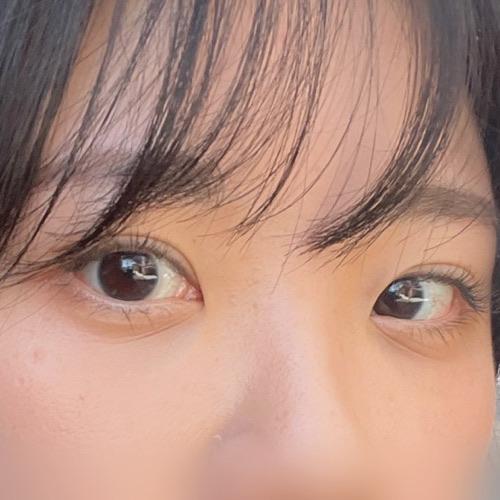 後