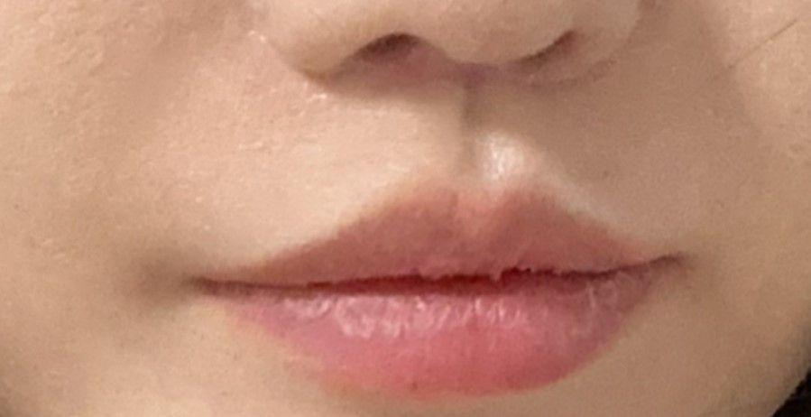 後