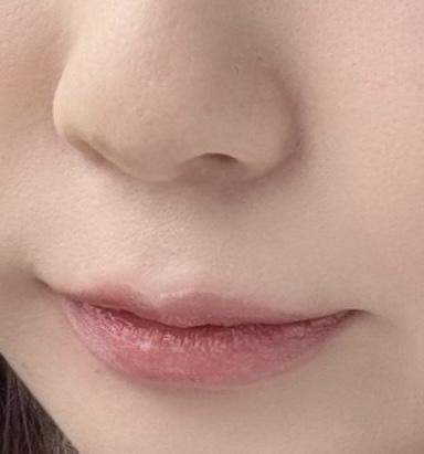 後
