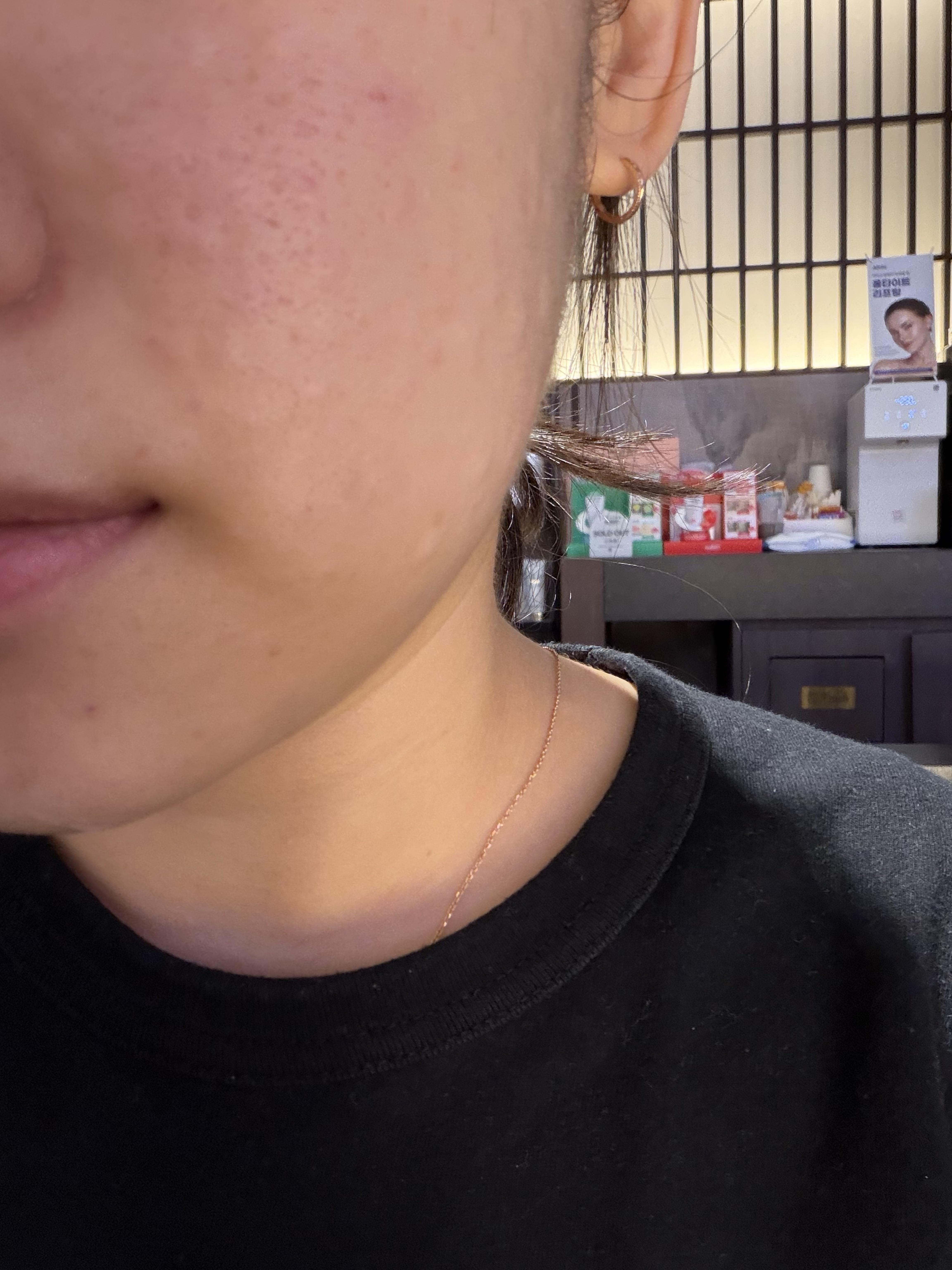 後