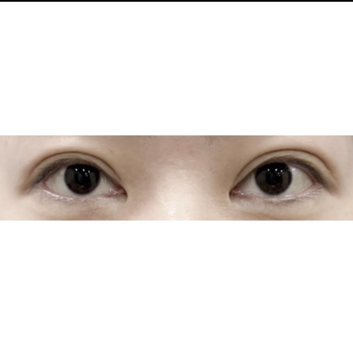 前