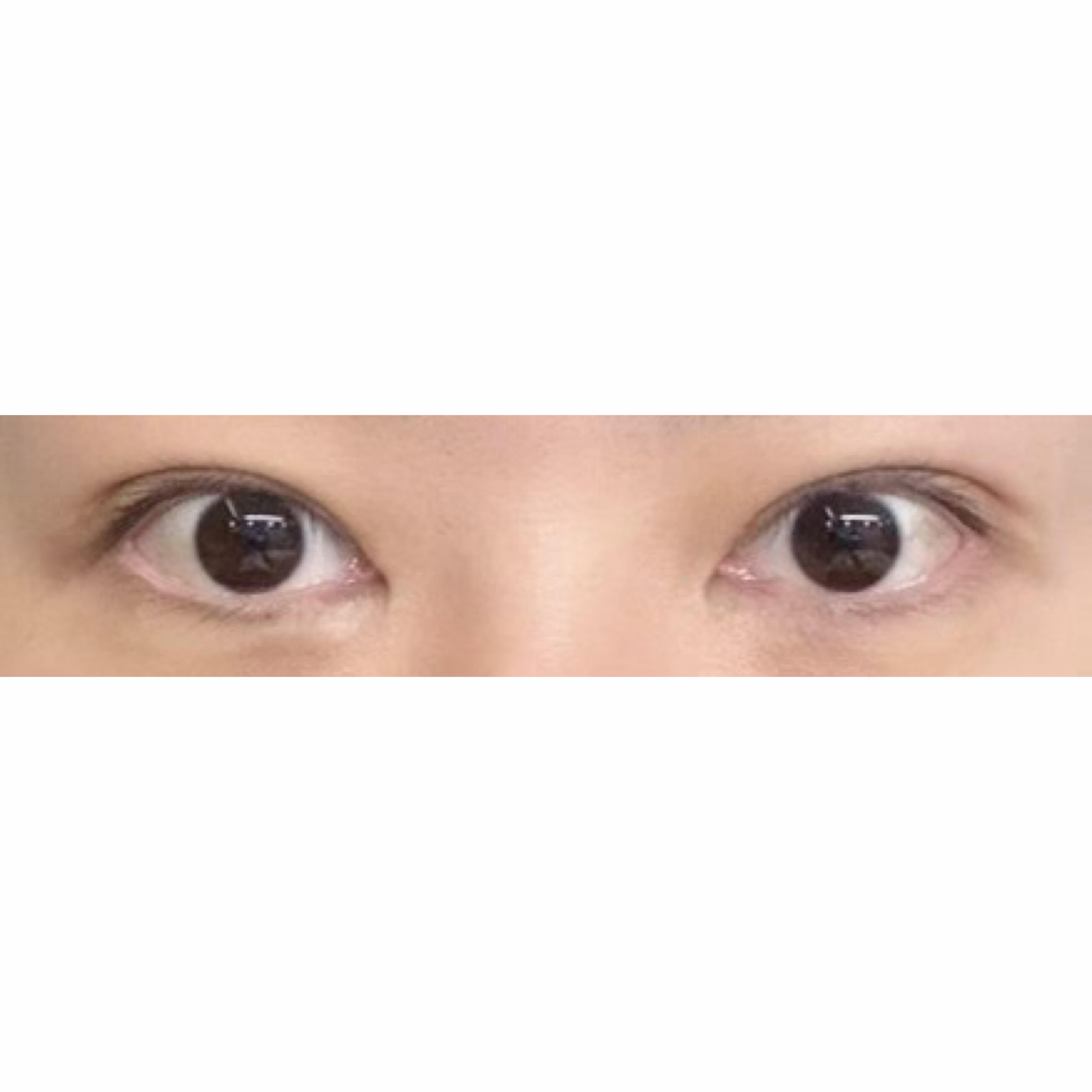 后