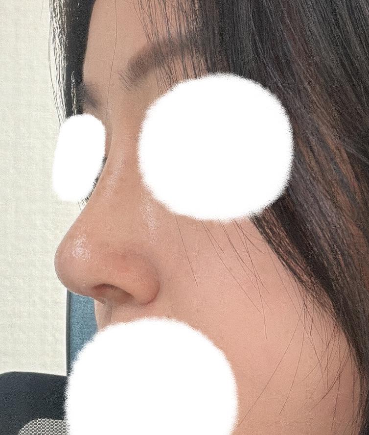 後