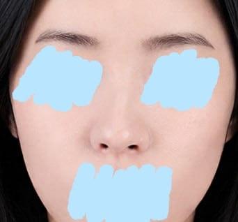 前