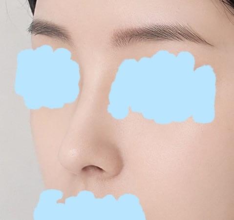 后