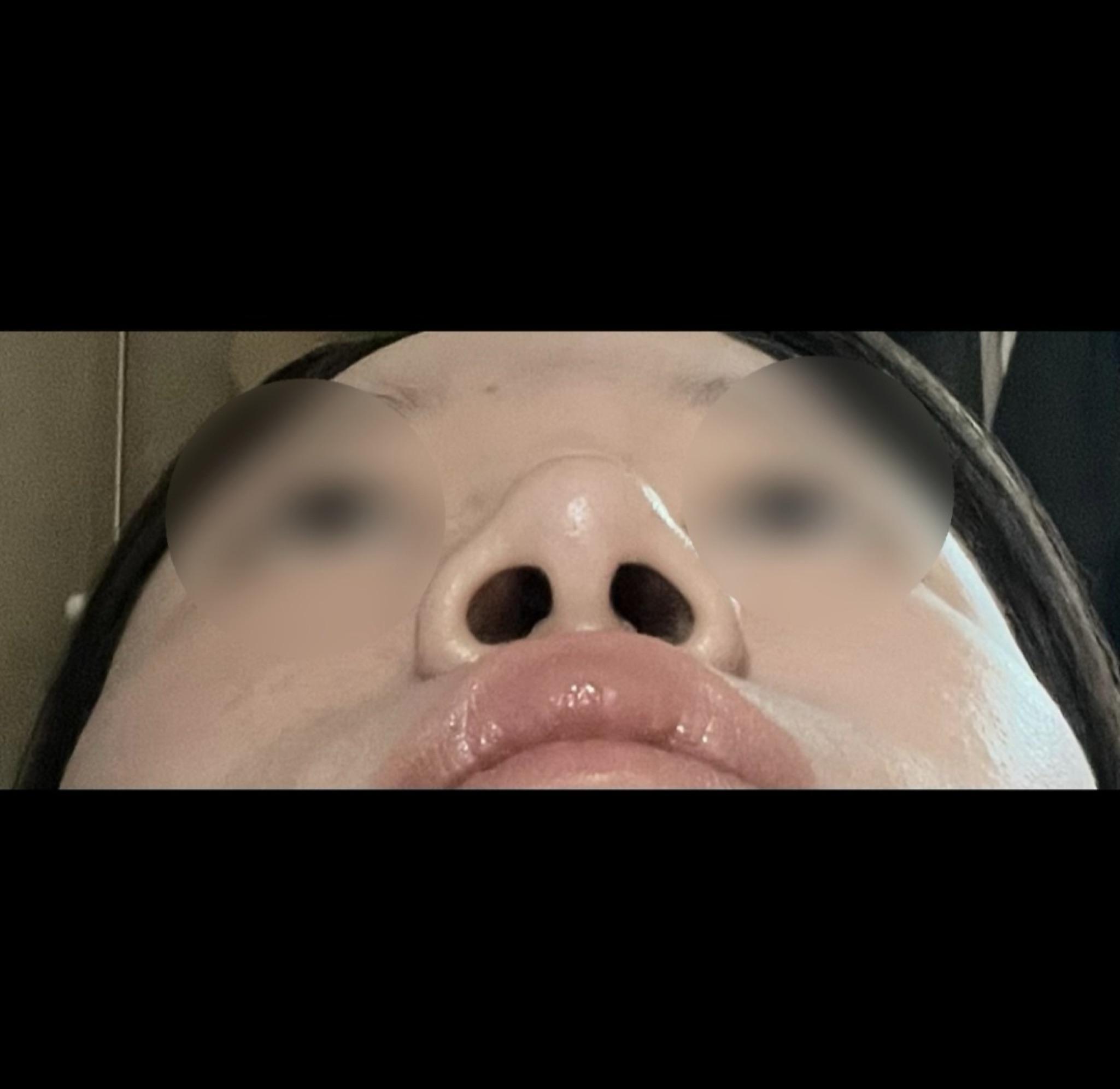 前