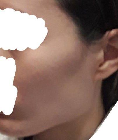 後
