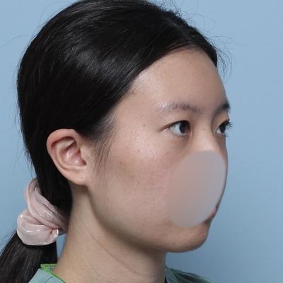 후기 사진 5