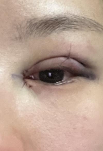 후기 사진 1