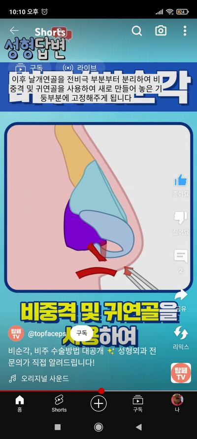 후기 사진 2