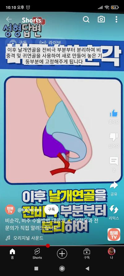 후기 사진 1