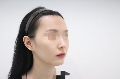 후기 사진 2