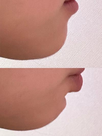 후기 사진 1