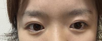 후기 사진 1