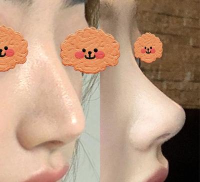 후기 사진 1