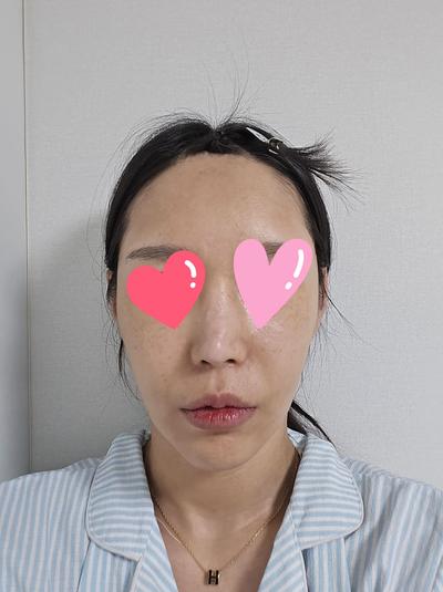후기 사진 1