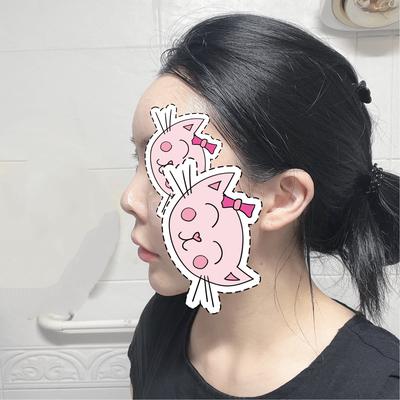 후기 사진 1