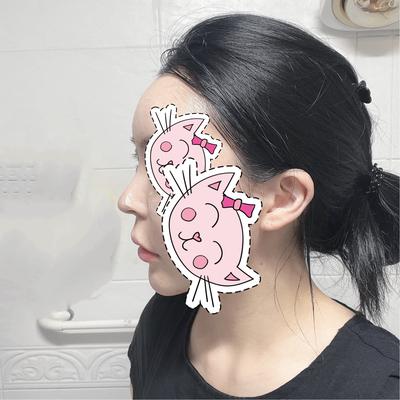 후기 사진 2