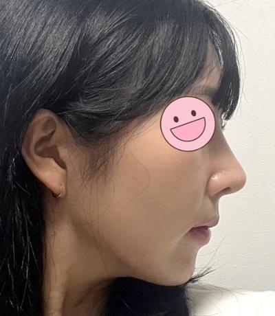 후기 사진 2