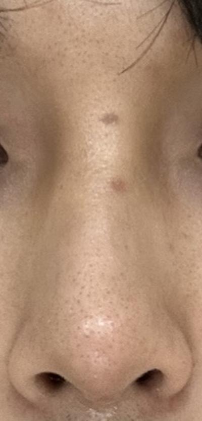 후기 사진 2