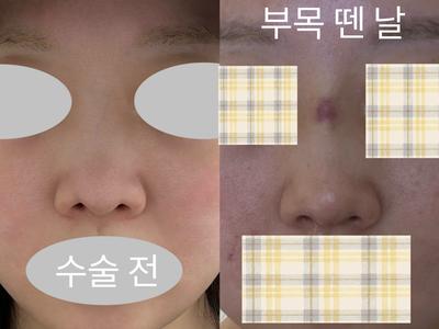 후기 사진 1
