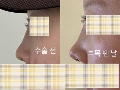 후기 사진 2