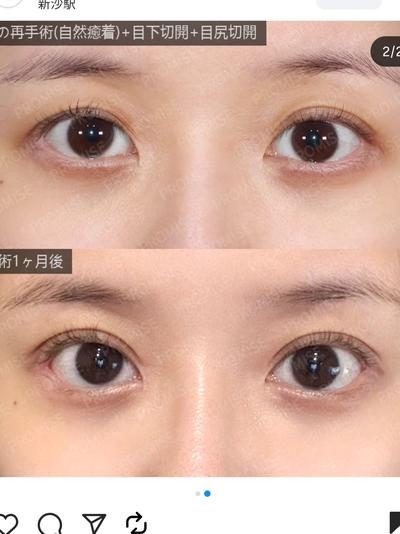 후기 사진 5