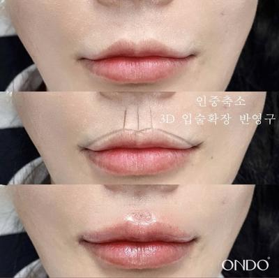 후기 사진 1
